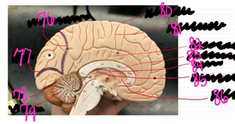 Practicum 2 Sagittal Cut Of The Brain Flashcards Quizlet