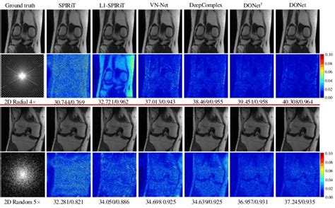 Comparison Of Different Methods In Terms Of Reconstruction Accuracy