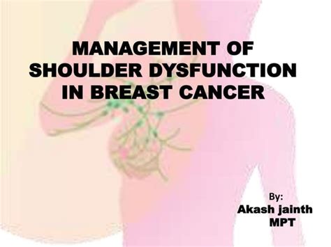 Management Of Shoulder Dysfunction In Breast Cancer Ppt