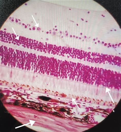 Retina Histology Diagram | Quizlet