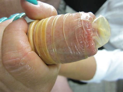 Alles Mit Condom Kondom Porn Pictures Xxx Photos Sex Images Pictoa