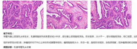 患有「乳腺肿瘤」的狗狗，该怎么防治不再遭受痛苦？ 知乎