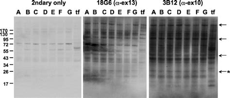 Presence Of C Terminal Disc1 Fragments In Human Brain Western Blots Of