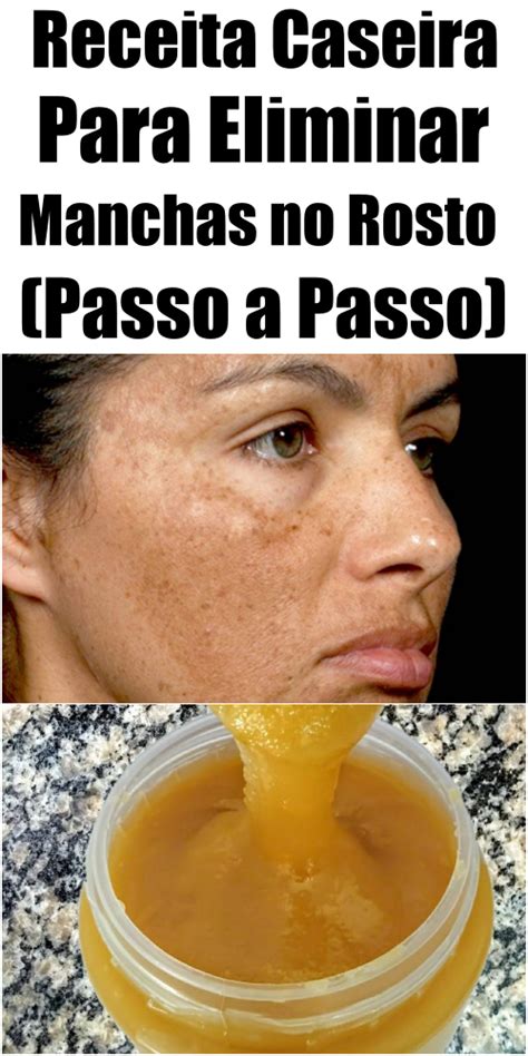 Receita Caseira Para Eliminar Manchas No Rosto Passo A Passo Food