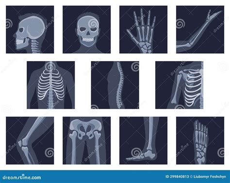 Orthopedic And Skeleton Symbols Human Joints And Bones Set Vector