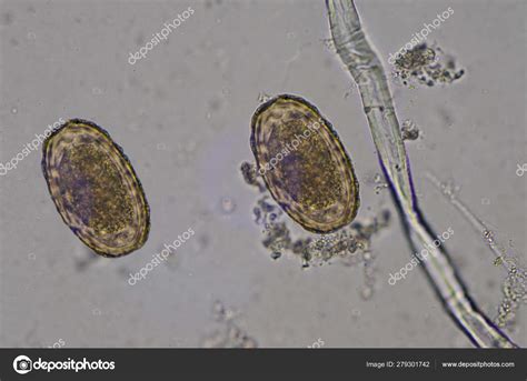 Parasites In Stool Microscope