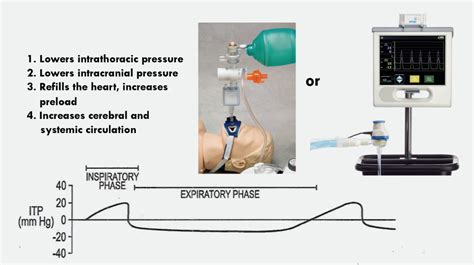 Active Intrathoracic Pressure Regulation During Resuscitation - JEMS ...