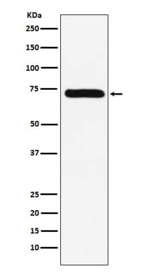 Coagulation Factor X Antibody SR2185 Novus Biologicals 100 μg