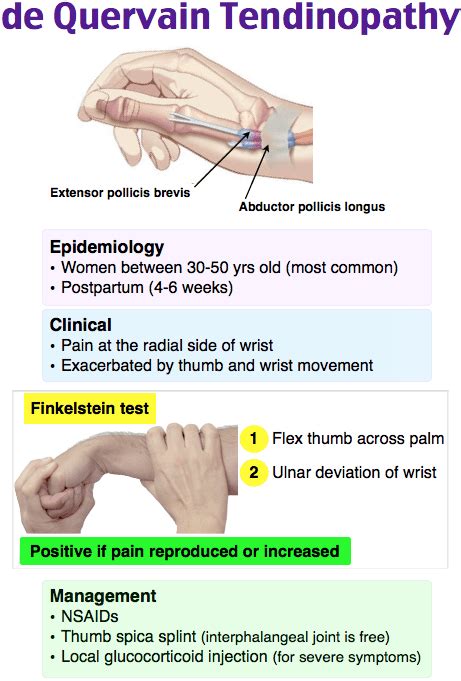 Image De Quervains Disease