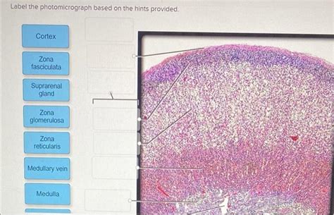 Solved Label The Photomicrograph Based On The Hints Chegg