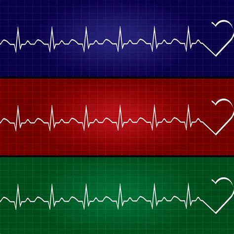 Heart Cardiogram Vector Charts Set Healthy Heart Rhythm Ischemia