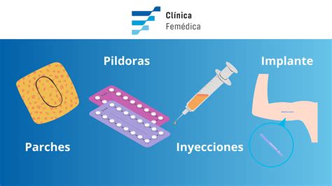 Tipos De M Todos Anticonceptivos