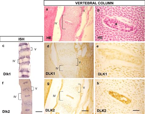 Embryonic vertebral column histology. a, b H&E increasing magnification ...