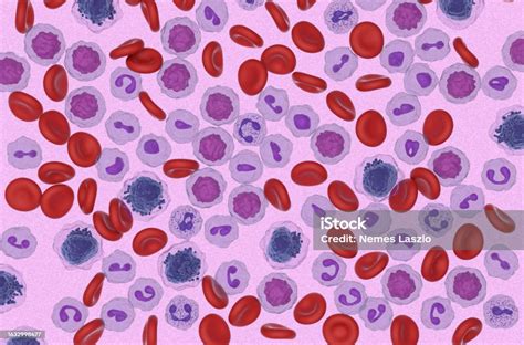 Foto De Células Da Leucemia Mieloide Aguda No Fluxo Sanguíneo