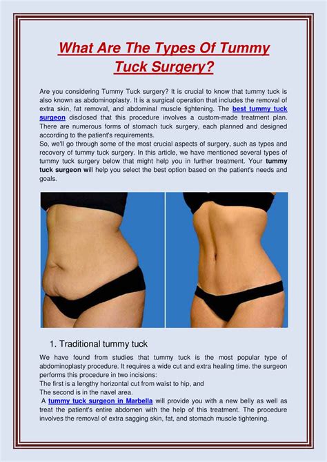 PPT What Are The Types Of Tummy Tuck Surgery PowerPoint Presentation