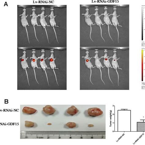 GFRAL Is Overexpressed In Pancreatic Cancer Tissues And Pancreatic