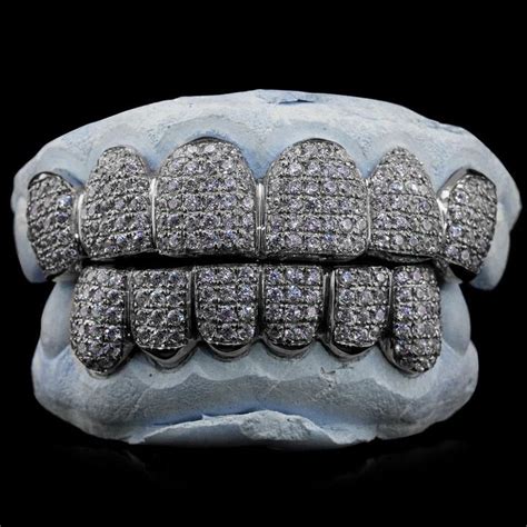 HUGE SALE on Gold Teeth, Silver, or Rose Gold Grillz - SHOP NOW ...