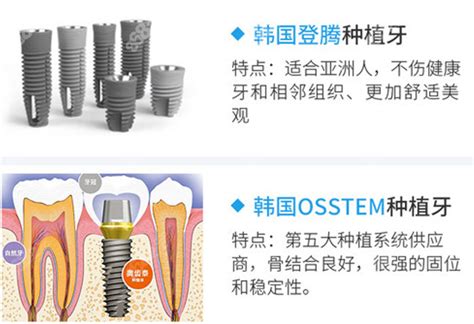 韩国进口种植牙价格为何那么低？价格2999颗是真实的吗种植牙 8682整形网