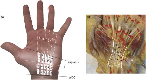 Flexor Retinaculum Of The Hand Atelier Yuwa Ciao Jp