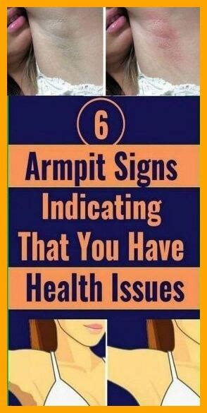 Armpit Signs Indicating That You Have Health Issues Artofit