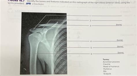 Solved Identify The Bones And Features Indicated On This Chegg