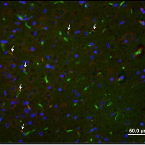 Representative Image Of Immunostaining With Ki 67 Cell Proliferation Download Scientific