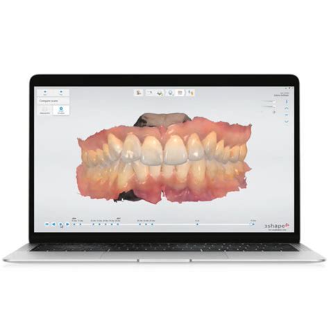 Dental Web Application Trios Move 3shape Management Treatment