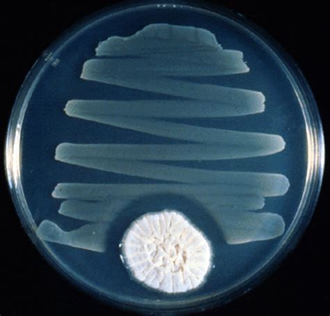 The discovery of Penicillin timeline | Timetoast timelines