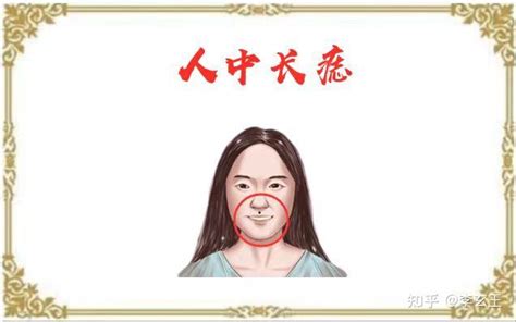 女性面相痣详解 知乎