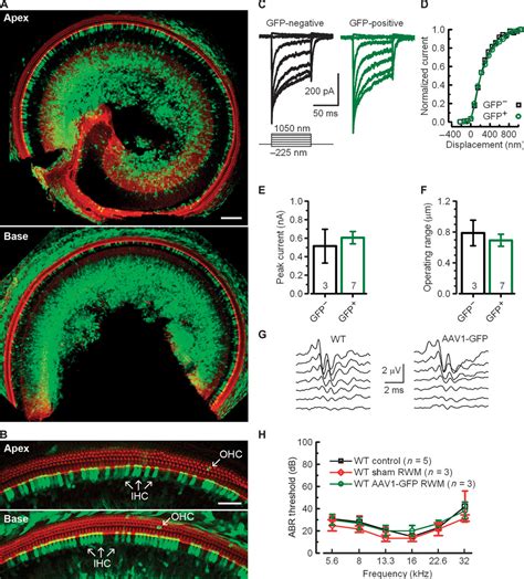 Tmc Gene Therapy Restores Auditory Function In Deaf Mice Science