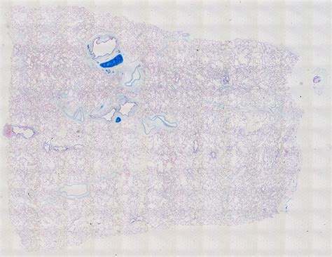 Alcian Blue Staining Of 29 Year Old Human Donor D175 11c211