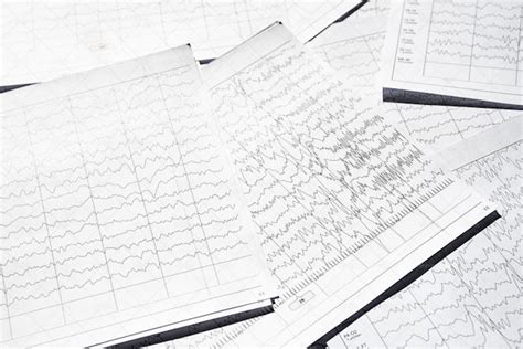 EEG Diagnostic Results - Stock Photos | Motion Array