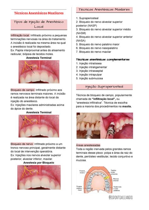 Tecnicas Anestesicas Na Odontologia RETOEDU