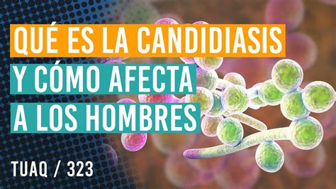 Qu Es La Candidiasis Y C Mo Afecta A Los Hombres Youtube