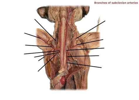 Branches Of Subclavian Arteries Diagram Quizlet