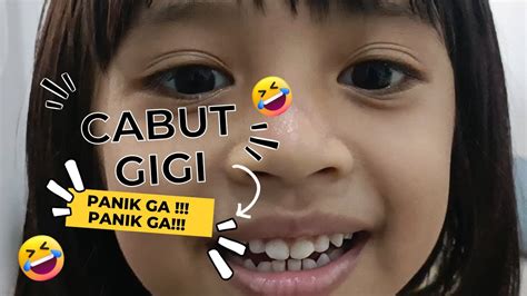 Cabut Gigi Susu Bawah Adzka Cabut Gigi Anak Di Dokter Gigi Youtube