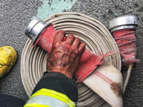 Fire Fighters Burn Scars Win Respect Peoples Daily Online