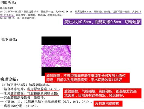 如何看懂肺癌【病理报告】？ 科普健康 首都医科大学附属北京胸科医院