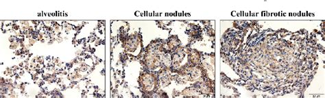 Figure 1 From Minute Cellular Nodules As Early Lesions In Rats With