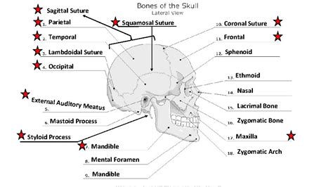 Naming The Bones Sagittal Suture Parietal Squamosal Suture