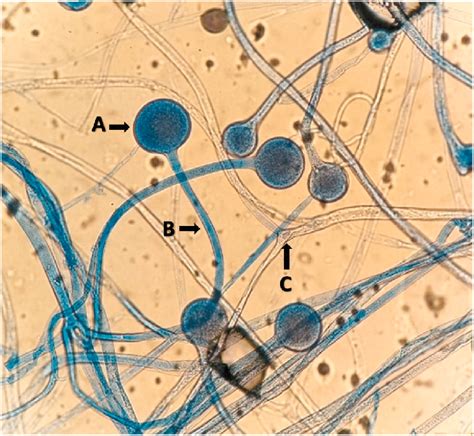 Rhizopus Sporangium