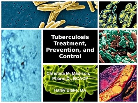 Pptx Tuberculosis Treatment Prevention And Control Christina M