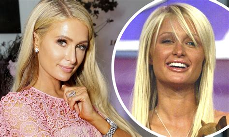 Paris Hilton Plastic Surgery Clinic Mono