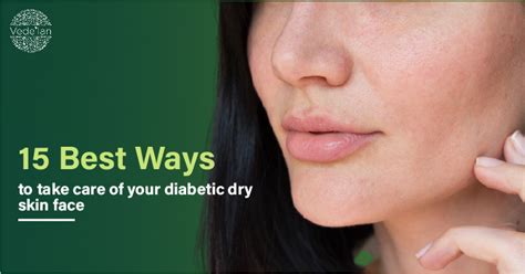 15 Best Ways To Take Care Of Your Diabetic Dry Skin Face Vedelan