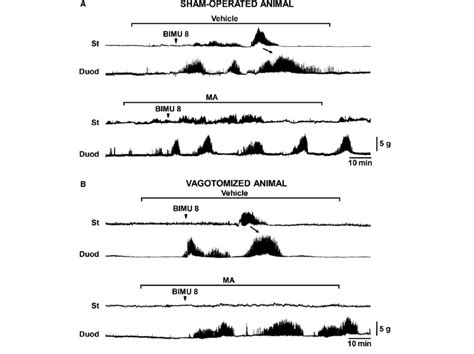 Effect Of Vagotomy On Bimu8 Induced Gastric And Duodenal Contractions