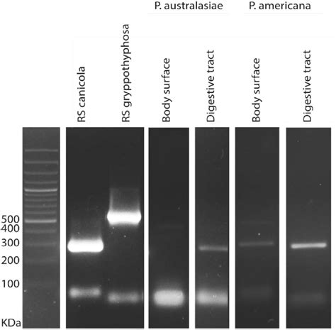 Examples Of Multiplex Pcr Agarose Gel Electrophoresis Amplified 285 And