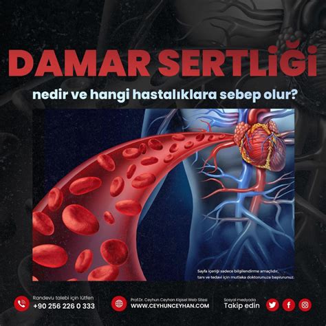 Damar Sertli I Nedir Ve Hangi Hastal Klara Sebep Olur Prof Dr