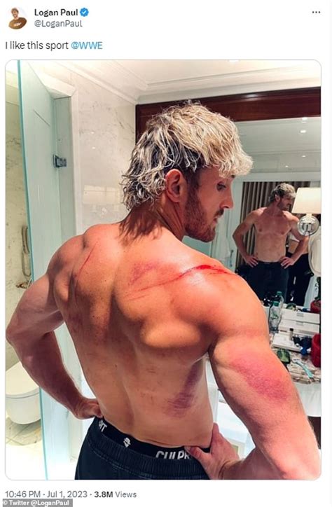 Logan Paul Reveals The Gruesome Injuries He Suffered After Being Thrown