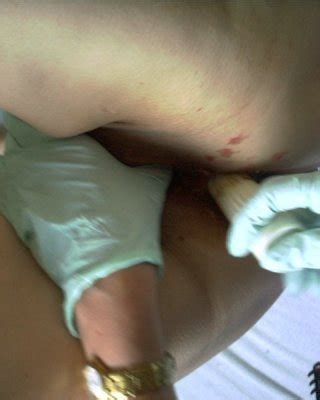 Whipping Porn Pics XXX Photos Sex Images App Page PICTOA