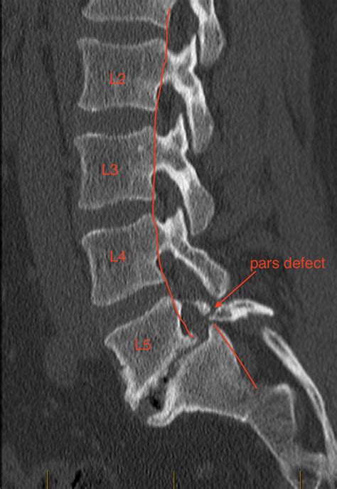 The Truth About Spinal Misalignment Farrelly Chiropractic